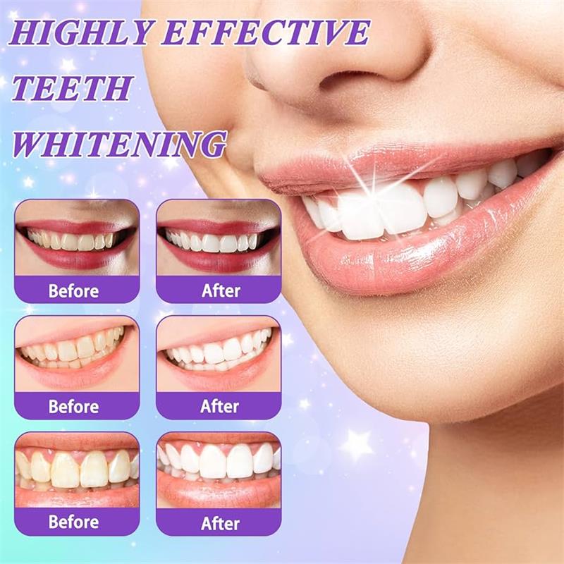 9D Purple Teeth Whitening Toot - Purple Toning Shampoo recensie en prijs