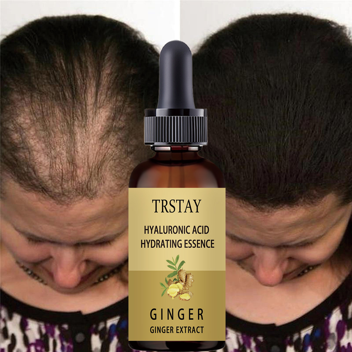 Hair Growth Serum Anti Prevent - Hair Care Gisou recensie en prijs