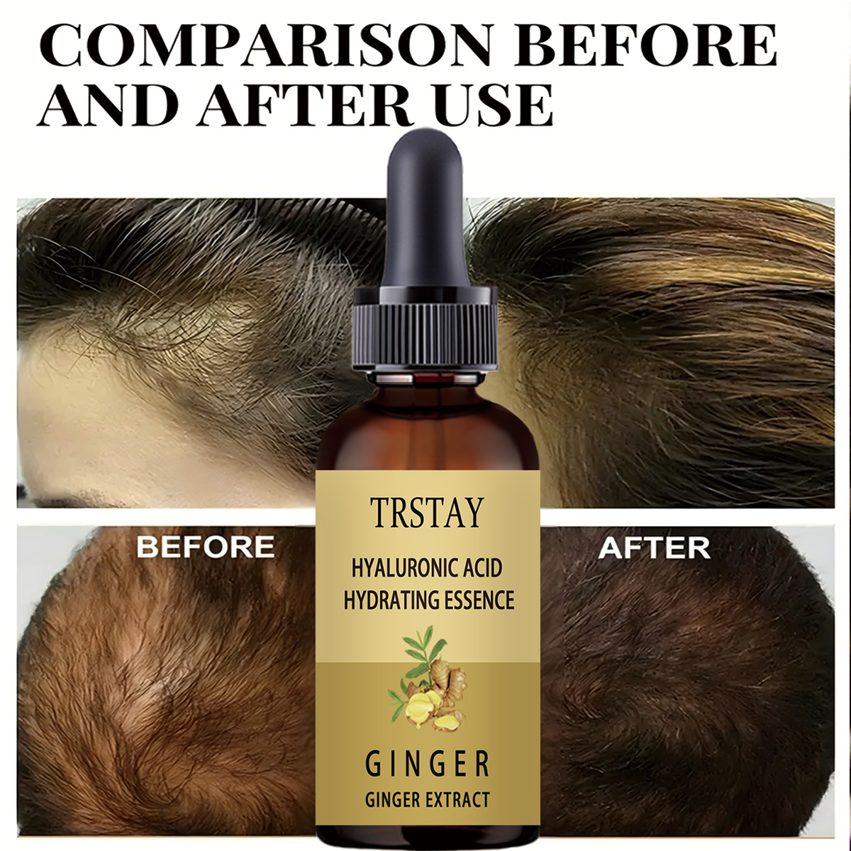 Hair Growth Serum Anti Prevent - Hair Care Gisou recensie en prijs