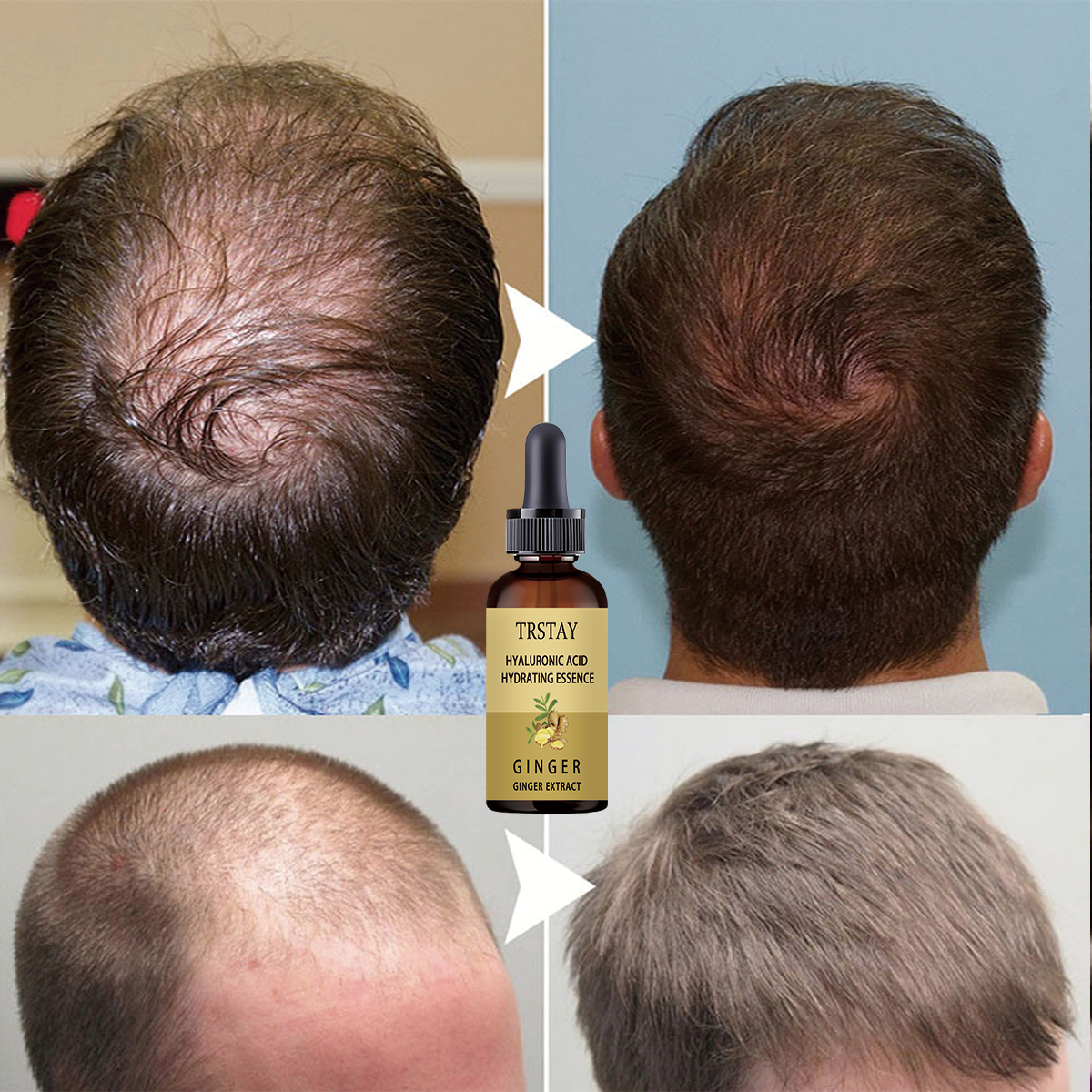 Hair Growth Serum Anti Prevent - Hair Care Gisou recensie en prijs