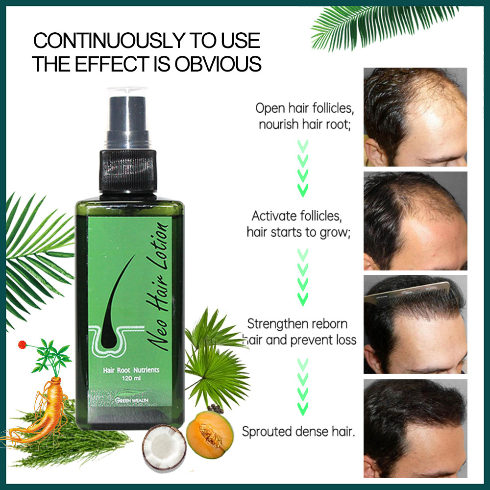 Original Neo Hair Lotion 120ml - Hair Care Gisou recensie en prijs