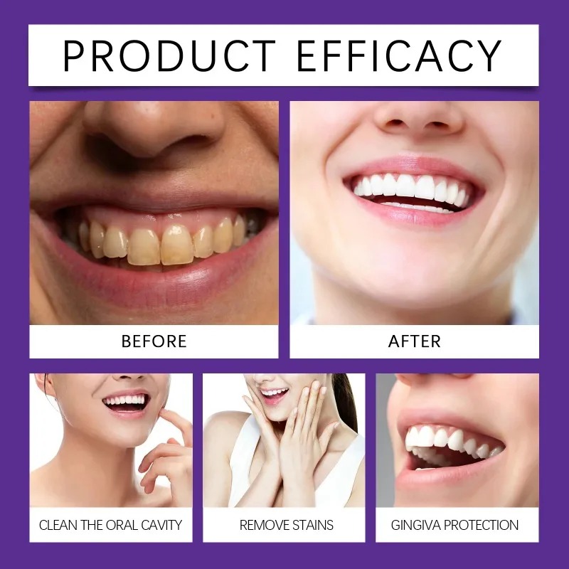 Purple Teeth Restoration Miner - Purple Toning Shampoo recensie en prijs